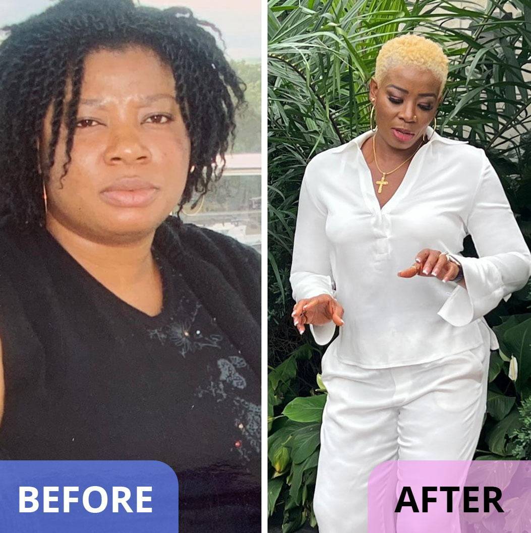 weight-loss-before-after