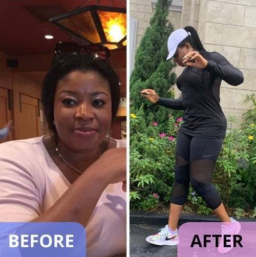 before-after-weight-loss